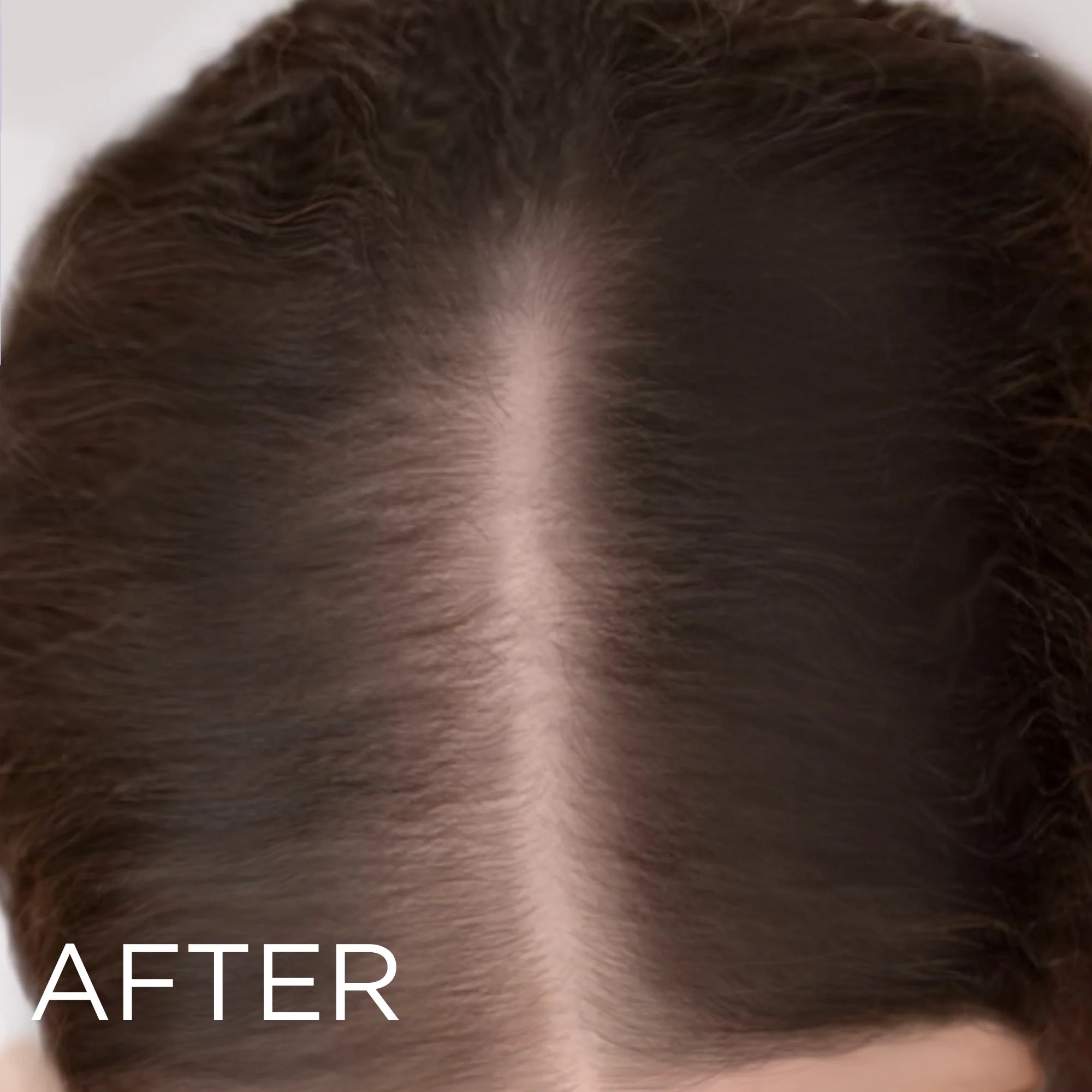 LED Hair Growth Brush – Stop Hair Loss & Regrow Hair Naturally